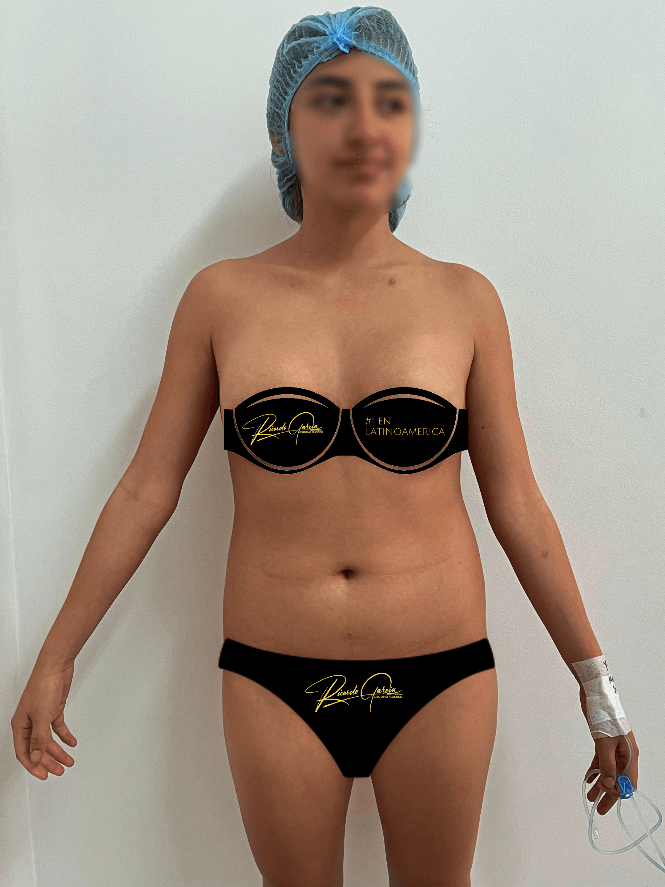Antes